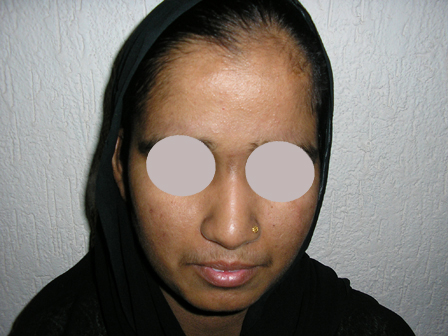 Dr Pandya Clinic Udaipur